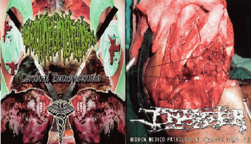 Infester (USA-2) : Infester - Hydropneumothorax